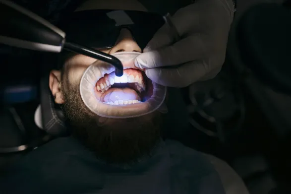 Dentist applying curing light